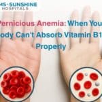 Pernicious Anaemia: When Your Body Can’t Absorb Vitamin B12 Properly