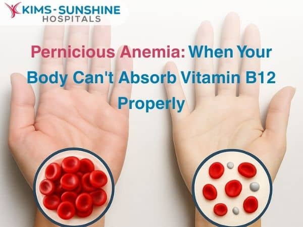 Pernicious Anaemia: When Your Body Can’t Absorb Vitamin B12 Properly