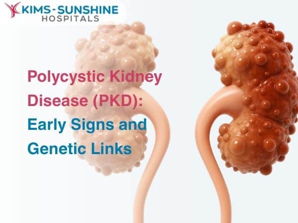 Polycystic Kidney Disease (PKD): Early Signs and Genetic Links