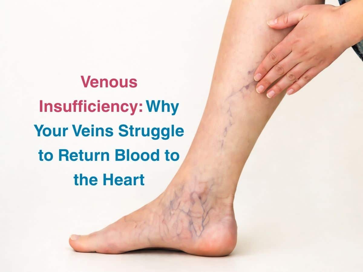 Dec-Venous Insufficiency_ Why Your Veins Struggle to Return Blood to the Heart - Multispeciality Hospital Venous Insufficiency: Why Your Veins Struggle to Return Blood to the Heart