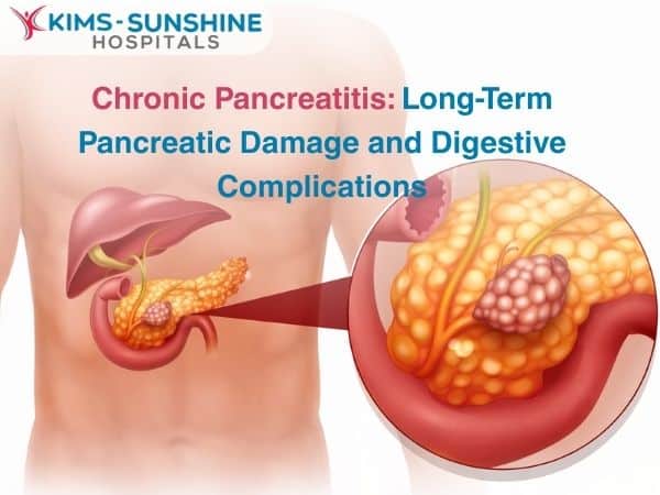 Chronic Pancreatitis: Long-Term Pancreatic Damage and Digestive Complications