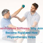 Post-Fracture Stiffness: Why Joints Become Rigid and How Physiotherapy Helps