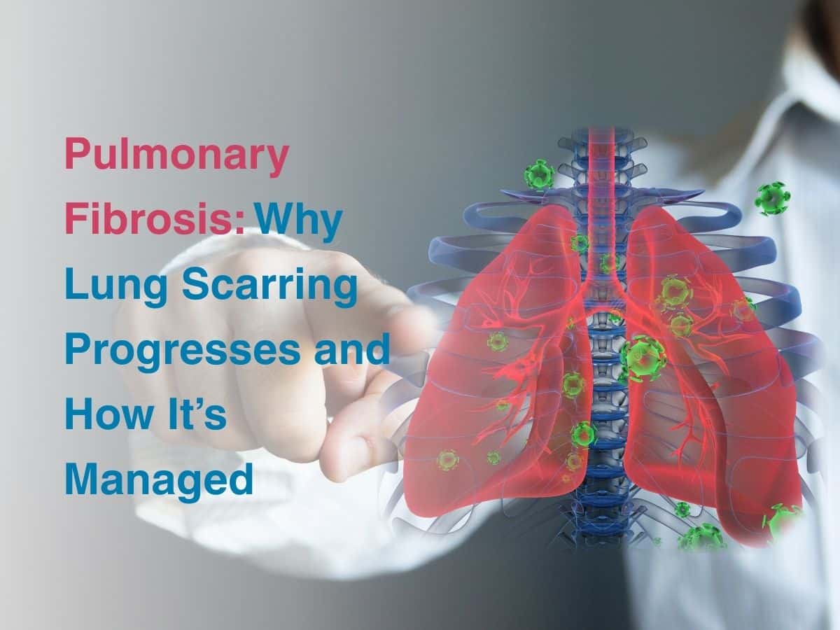 Pulmonary Fibrosis_ Why Lung Scarring Progresses and How Its Managed - Multispeciality Hospital Pulmonary Fibrosis: Why Lung Scarring Progresses and How It’s Managed