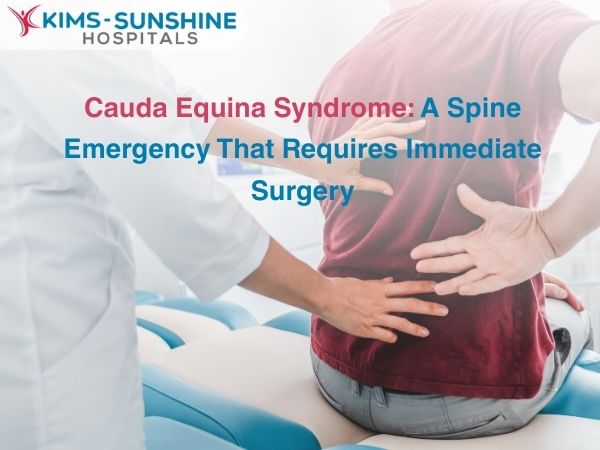 Cauda Equina Syndrome: A Spine Emergency That Requires Immediate Surgery