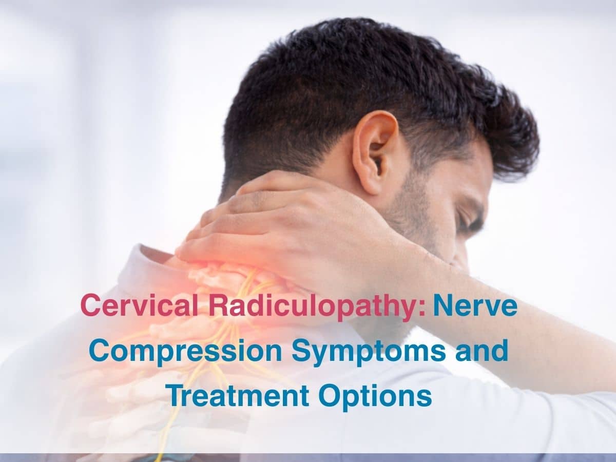 Cervical Radiculopathy: Nerve Compression Symptoms and Treatment Options