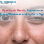 Myasthenia Gravis: Autoimmune Muscle Weakness and Its Early Signs