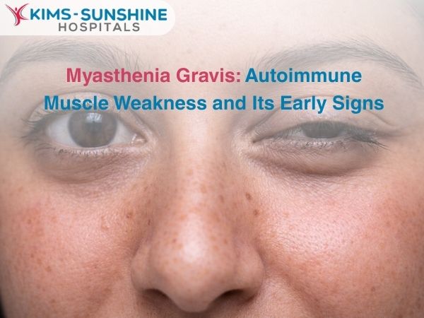 Myasthenia Gravis: Autoimmune Muscle Weakness and Its Early Signs