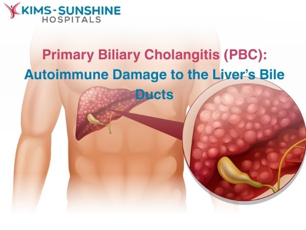 Primary Biliary Cholangitis (PBC): Autoimmune Damage to the Liver’s Bile Ducts