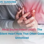 Atrial Septal Defect (ASD): The Silent Heart Hole That Often Goes Unnoticed