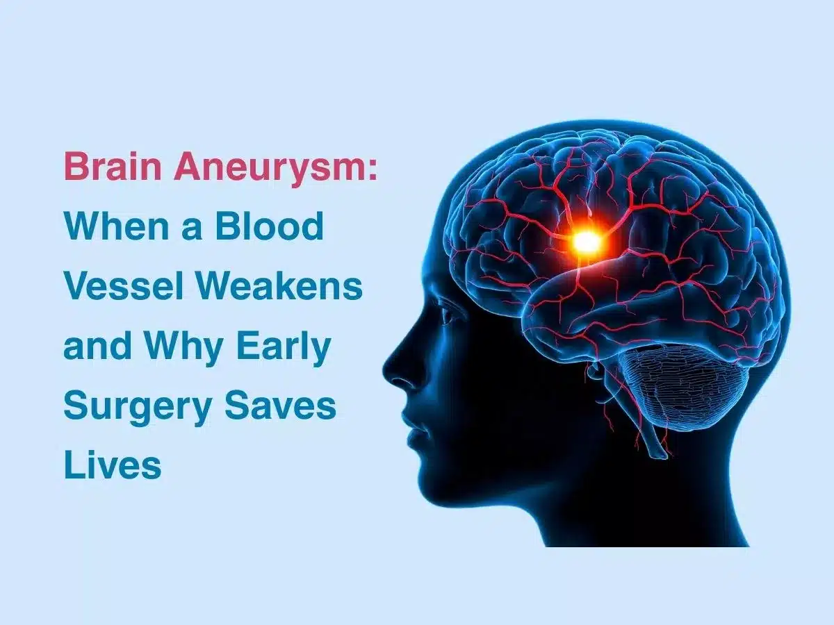 Brain Aneurysm: When a Blood Vessel Weakens and Why Early Surgery Saves Lives