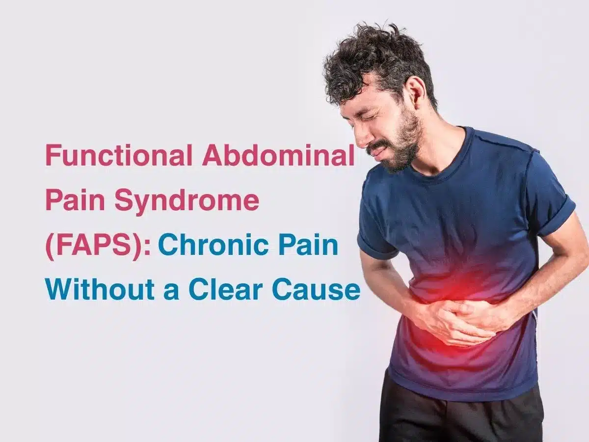 Functional Abdominal Pain Syndrome (FAPS): Chronic Pain Without a Clear Cause