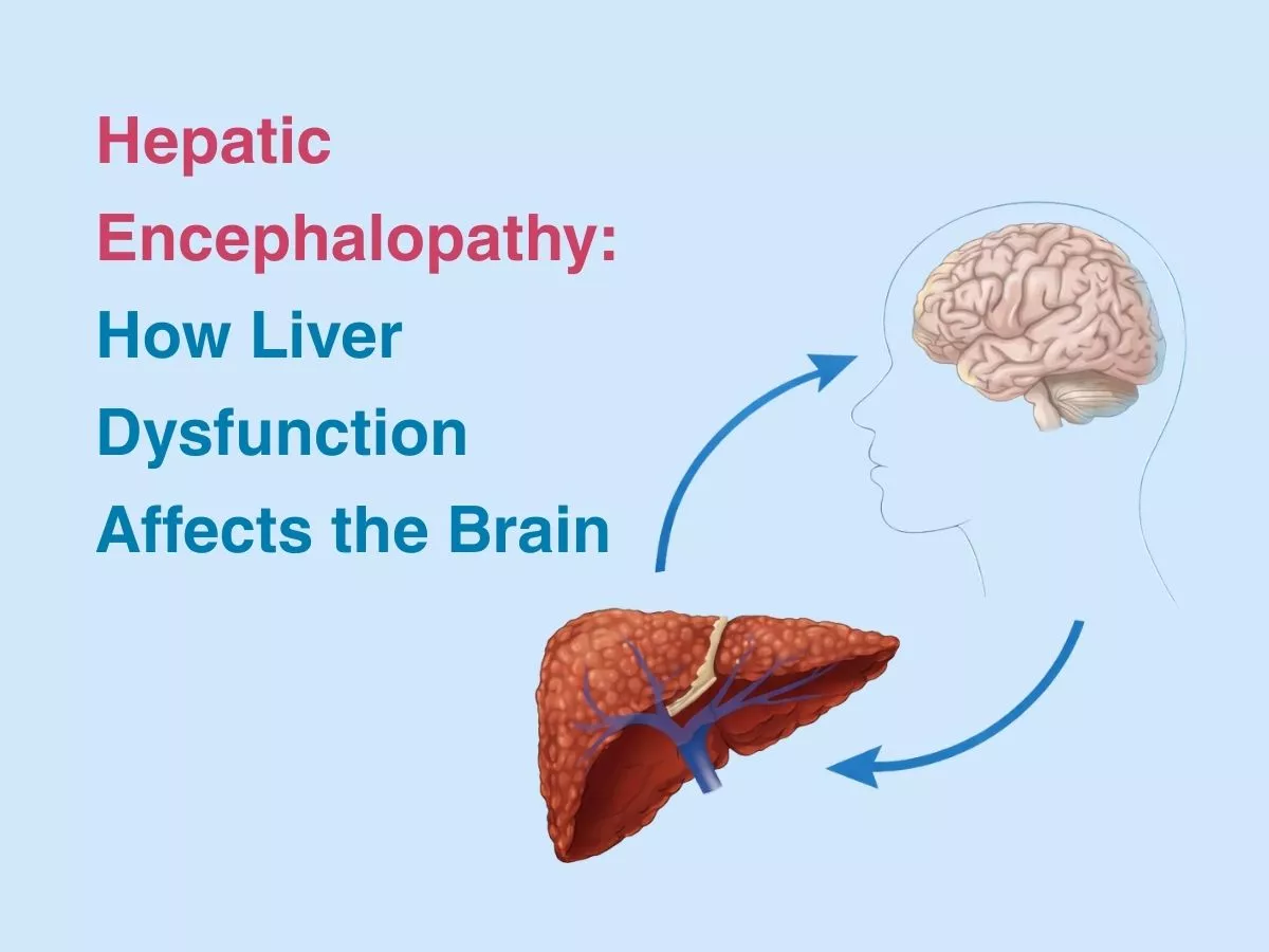 hepatic-encephalopathy-how-liver-dysfunction-affects-the-brain-69a25f1e600a9 - Multispeciality Hospital Hepatic Encephalopathy: How Liver Dysfunction Affects the Brain