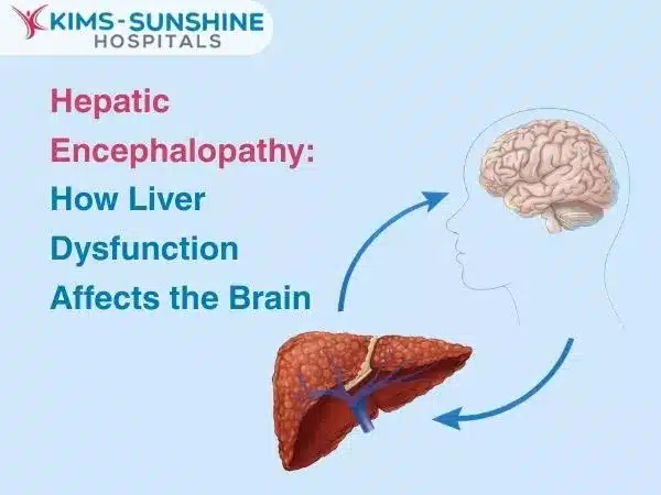 Hepatic Encephalopathy: How Liver Dysfunction Affects the Brain