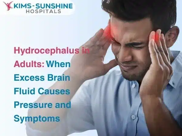 Hydrocephalus in Adults: When Excess Brain Fluid Causes Pressure and Symptoms