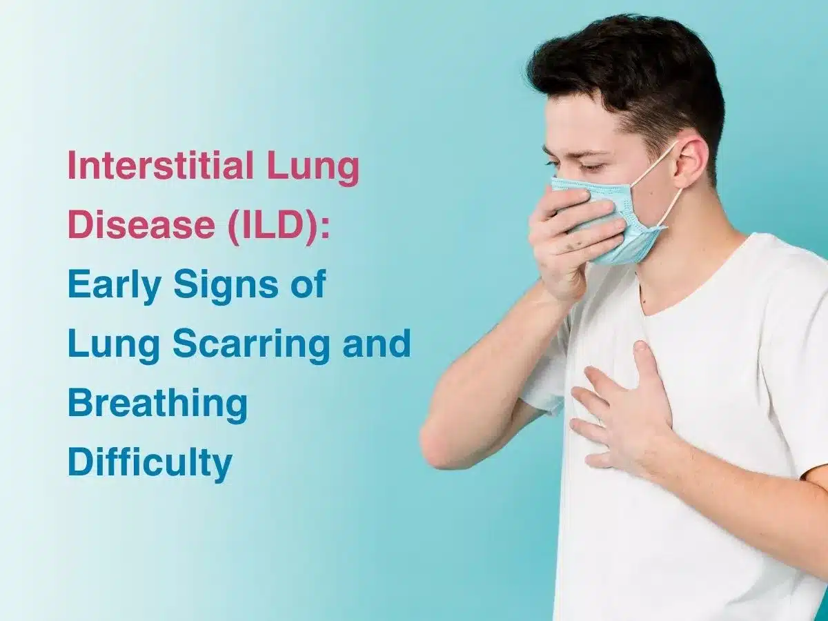 Interstitial Lung Disease (ILD): Early Signs of Lung Scarring and Breathing Difficulty