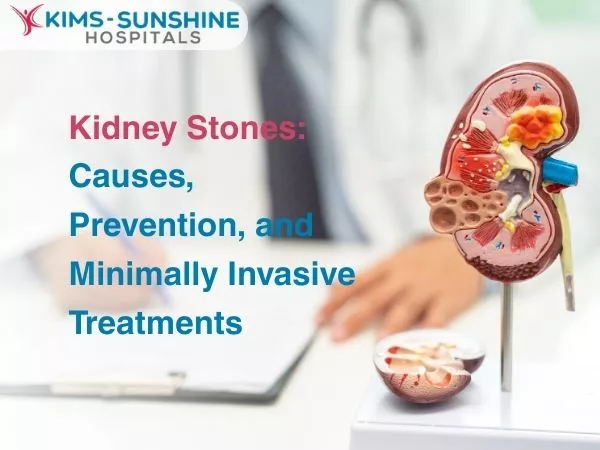 Kidney Stones: Causes, Prevention, and Minimally Invasive Treatments