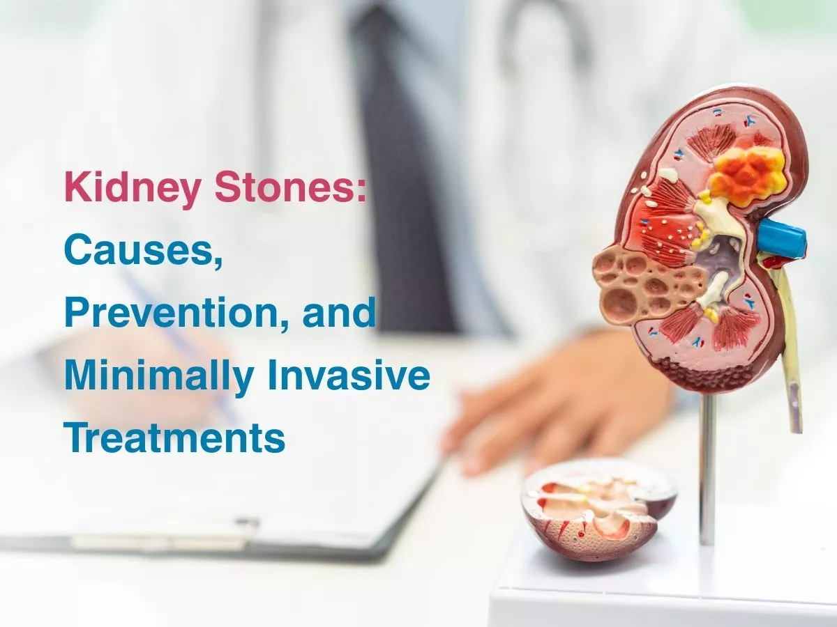 kidney-stones-causes-prevention-and-minimally-invasive-treatments-699be2984ab1c - Multispeciality Hospital Kidney Stones: Causes, Prevention, and Minimally Invasive Treatments