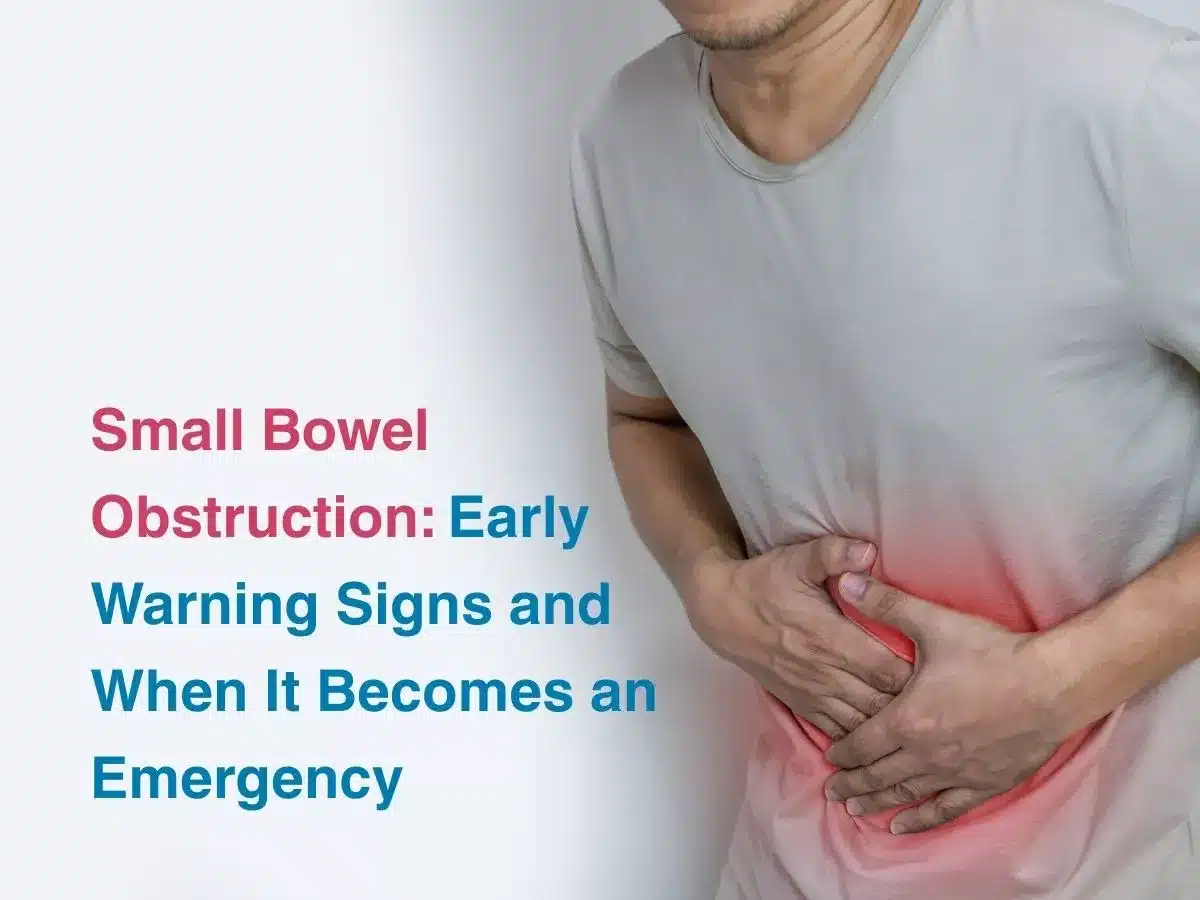 Small Bowel Obstruction: Early Warning Signs and When It Becomes an Emergency