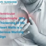Ventricular Hypertrophy: Why Thickening of the Heart Walls Is a Serious Warning Sign