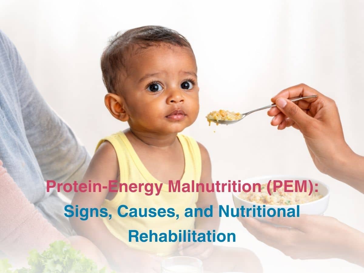 Protein-Energy Malnutrition PEM_ Signs Causes and Nutritional Rehabilitation - Multispeciality Hospital Protein-Energy Malnutrition (PEM): Signs, Causes, and Nutritional Rehabilitation