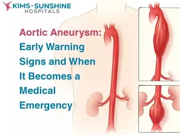 Aortic Aneurysm: Early Warning Signs and When It Becomes a Medical Emergency