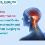 Chiari Malformation: Structural Brain Abnormality and When Surgery Is Needed
