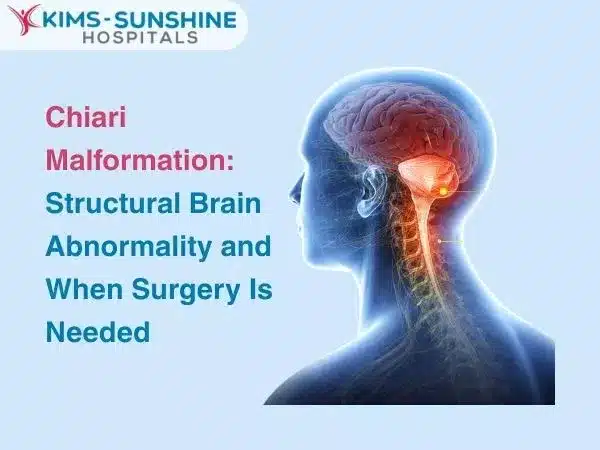 Chiari Malformation: Structural Brain Abnormality and When Surgery Is Needed