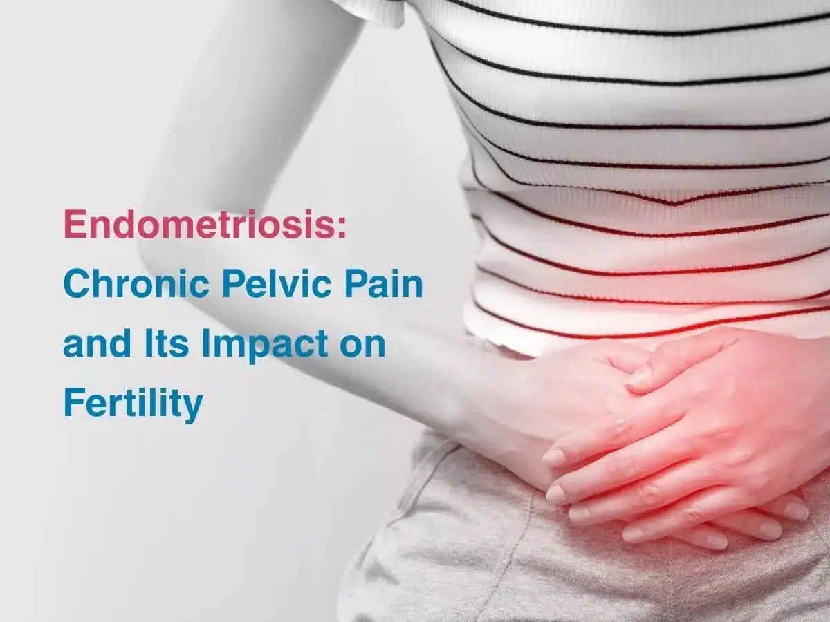 Endometriosis: Chronic Pelvic Pain and Its Impact on Fertility