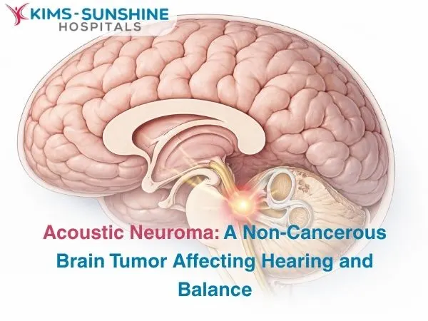 Acoustic Neuroma_ A Non-Cancerous Brain Tumor Affecting Hearing and Balance