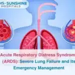 Acute Respiratory Distress Syndrome ARDS_ Severe Lung Failure and Its Emergency Management