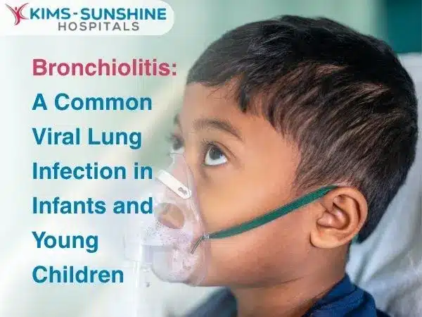 Bronchiolitis_ A Common Viral Lung Infection in Infants and Young Children 1