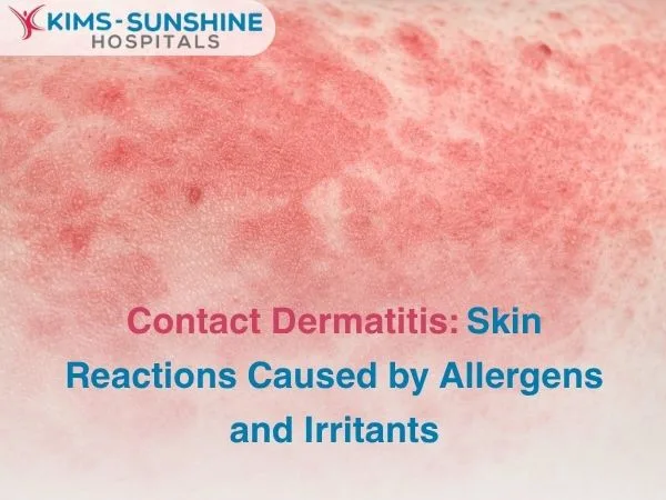 Contact Dermatitis_ Skin Reactions Caused by Allergens and Irritants