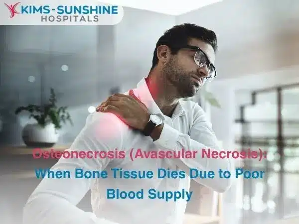 Osteonecrosis (Avascular Necrosis)_ When Bone Tissue Dies Due to Poor Blood Supply