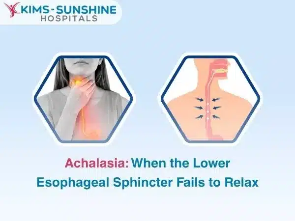 Achalasia: When the Lower Esophageal Sphincter Fails to Relax