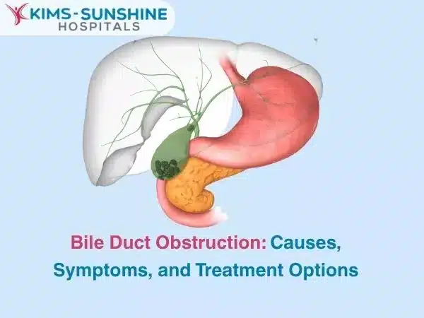 Bile Duct Obstruction: Causes, Symptoms, and Treatment Options