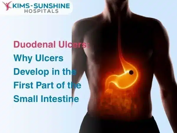 Duodenal Ulcers: Why Ulcers Develop in the First Part of the Small Intestine