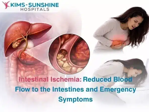 Intestinal Ischemia: Reduced Blood Flow to the Intestines and Emergency Symptoms