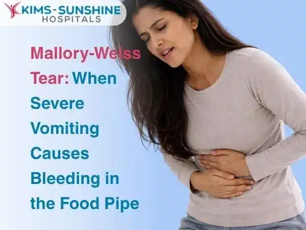 Mallory-Weiss Tear: When Severe Vomiting Causes Bleeding in the Food Pipe