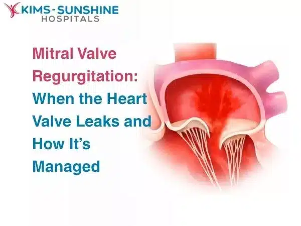 Mitral Valve Regurgitation: When the Heart Valve Leaks and How It’s Managed