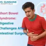 Short Bowel Syndrome: Digestive Challenges After Intestinal Surgery