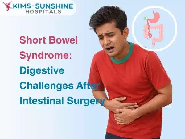 Short Bowel Syndrome: Digestive Challenges After Intestinal Surgery