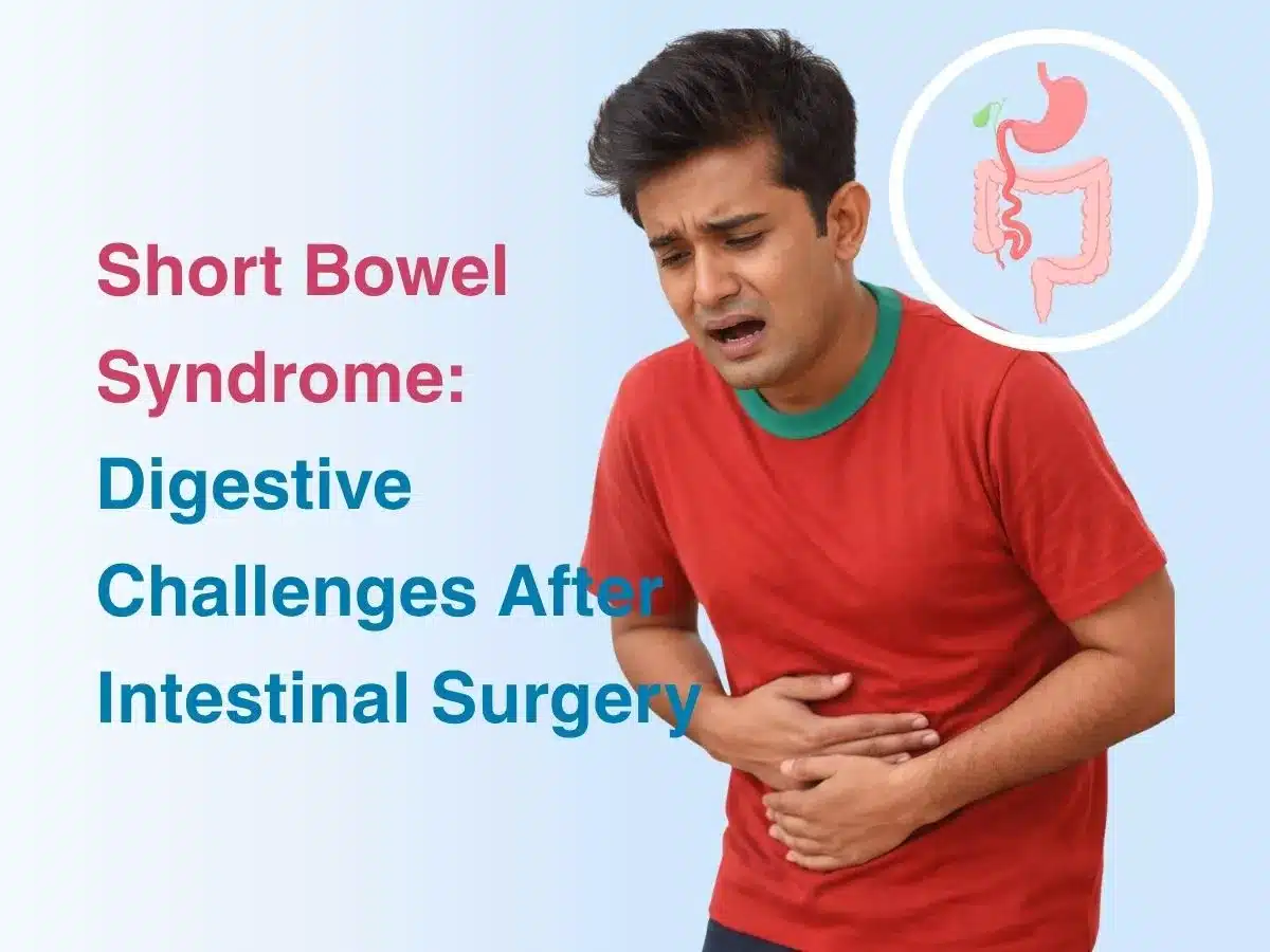 short-bowel-syndrome-digestive-challenges-after-intestinal-surgery-69ce36dc093d7 - Multispeciality Hospital Short Bowel Syndrome: Digestive Challenges After Intestinal Surgery