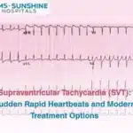 Supraventricular Tachycardia (SVT): Sudden Rapid Heartbeats and Modern Treatment Options