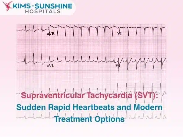 Supraventricular Tachycardia (SVT): Sudden Rapid Heartbeats and Modern Treatment Options