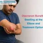 Olecranon Bursitis: Swelling at the Elbow and Treatment Options