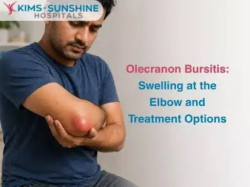 Olecranon Bursitis: Swelling at the Elbow and Treatment Options