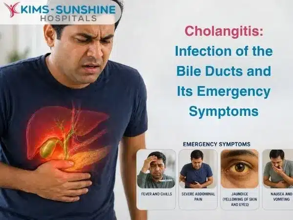 Cholangitis_ Infection of the Bile Ducts and Its Emergency Symptoms