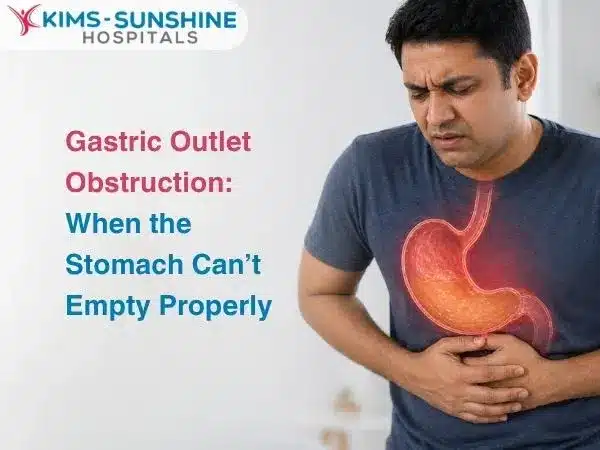 Gastric Outlet Obstruction_ When the Stomach Cant Empty Properly