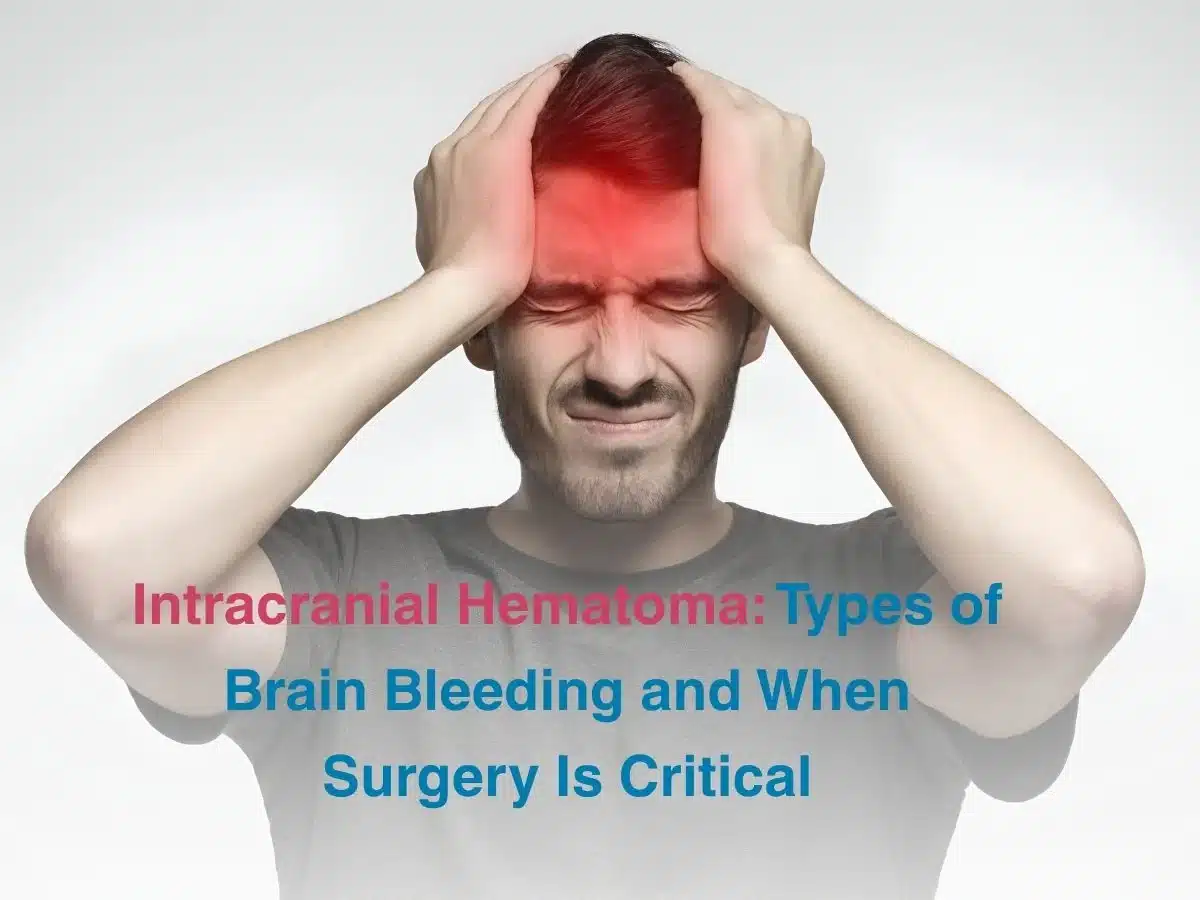 Intracranial Hematoma_ Types of Brain Bleeding and When Surgery Is Critical