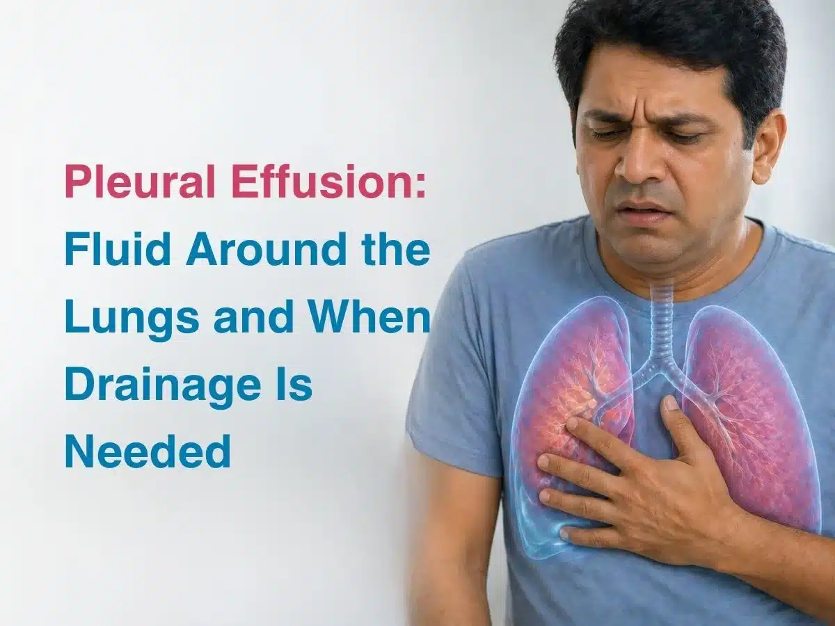 Educational graphic on pleural effusion: man clutching his chest beside the title 'Pleural Effusion: Fluid Around the Lungs and When Drainage Is Needed' with a lung illustration.